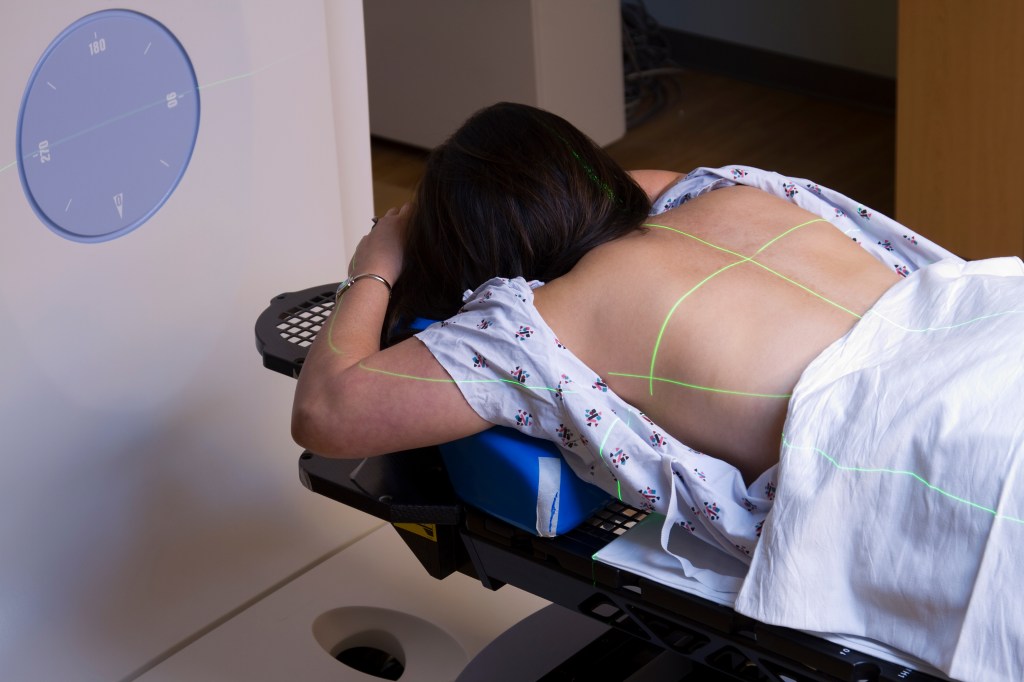 A woman undergoing radiation therapy treatment for lung cancer in a hospital bed